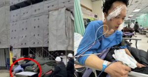 Dien Vien To Duc Duong Gay Xuong Mat Hon Me Vi Tai Nan Phim Truong 856