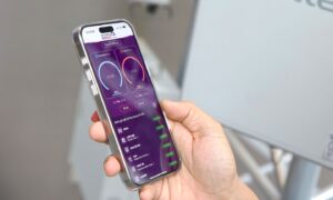 do toc do mang tren i speed