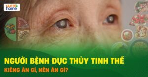 Duc Thuy Tinh The Kieng An Gi 01