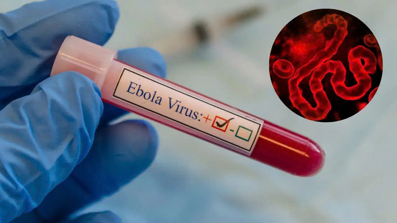 ebolaanh istock 1779427767962153867211