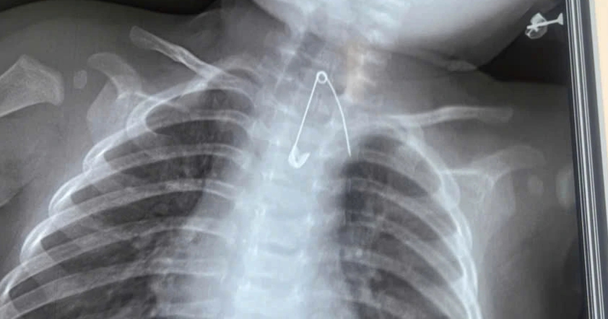 Edit 61068291013926871717002272732398482795142174N 1767889918415277752125 0 0 526 842 Crop 176789000