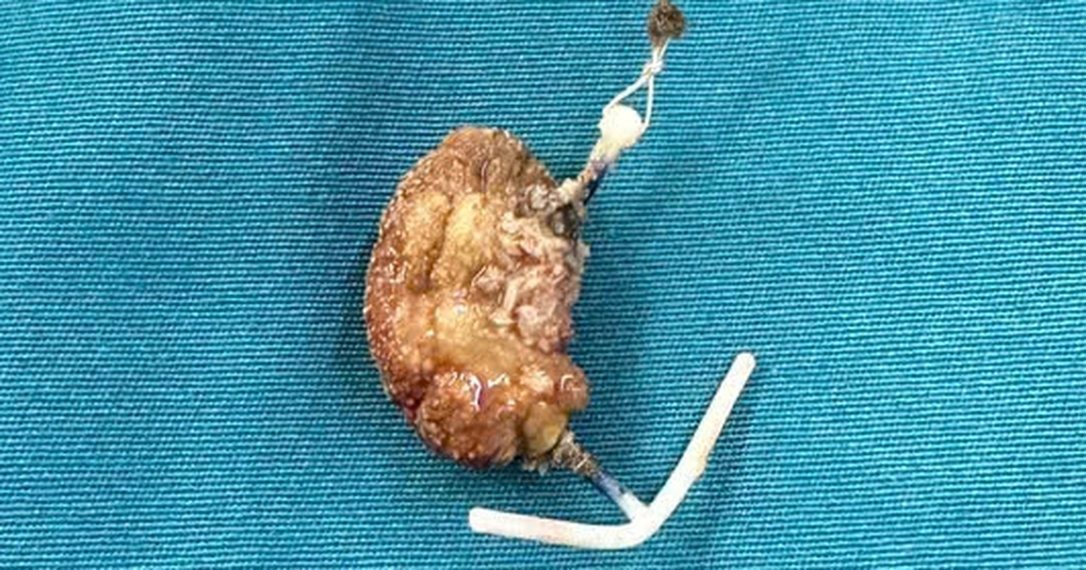 Edit A487D962 34C1 408D A876 299E1E544133 17689760980262131470402 146 0 479 532 Crop 176898062762079