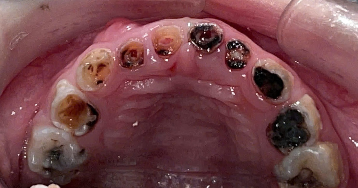 Gay Me 17706123734681696828918 0 0 928 1484 Crop 1770612380238950034085