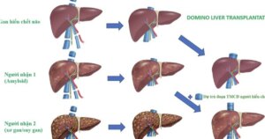 ghep tang benh vien 17738913524951460258748 0 13 505 821 crop 1773894197593915368194