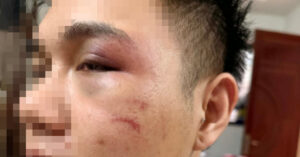 ha noi tu choi cho khach say xin tai xe xe cong nghe bi danh sung mat 1460