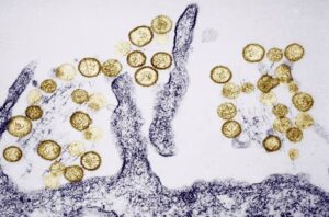 hantavirus