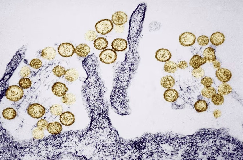 hantavirus