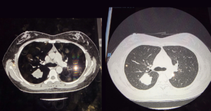 hinh ct 177425665619138413393 71 0 1411 2560 crop 17742571514151305458416