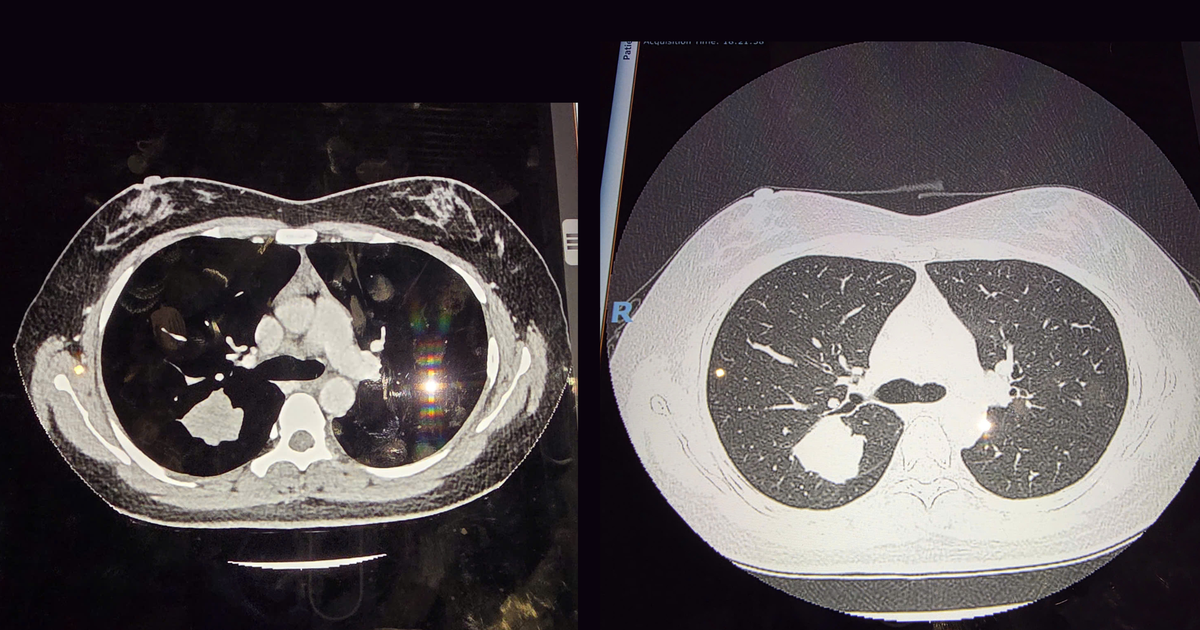 hinh ct 177425665619138413393 71 0 1411 2560 crop 17742571514151305458416