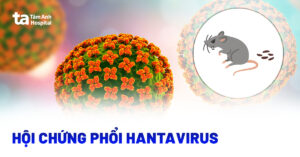 hoi chung phoi do virus hanta