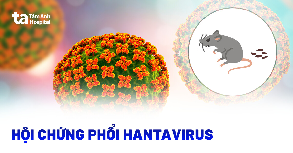 hoi chung phoi do virus hanta
