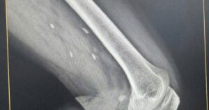 Img20260122082636 1769047406387575612290 29 0 479 720 Crop 1769047550481120881114