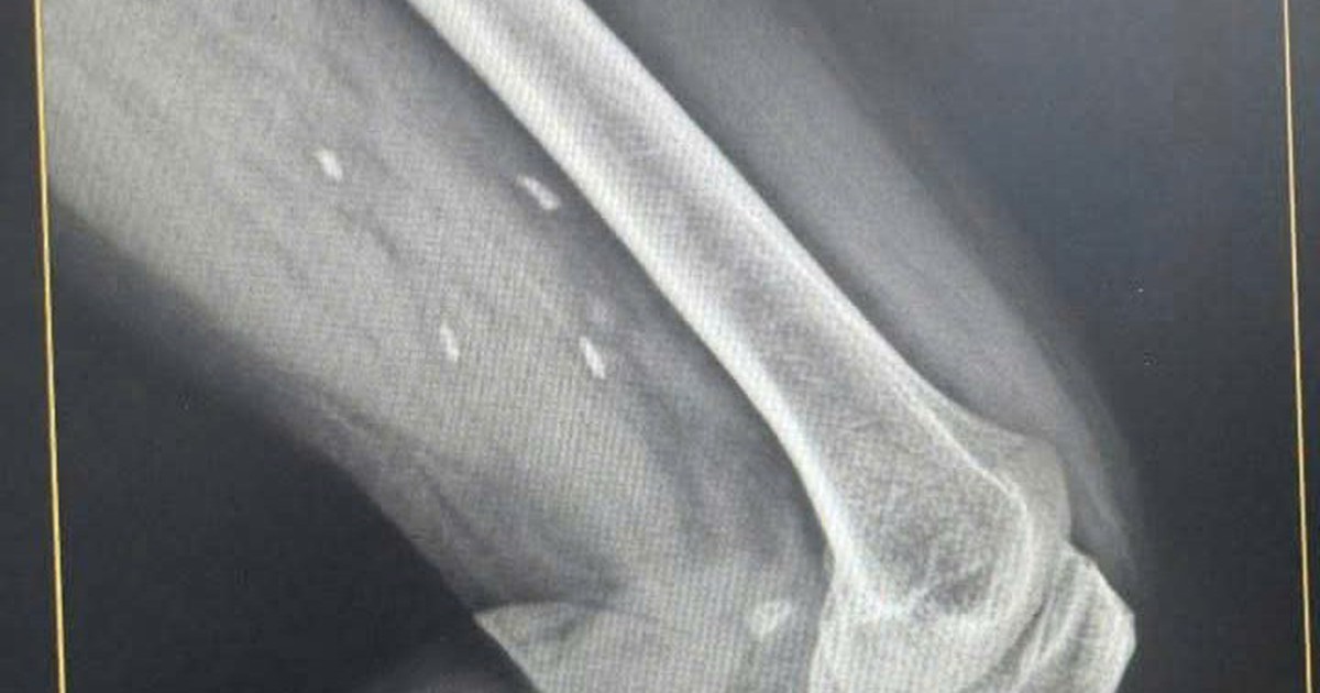 Img20260122082636 1769047406387575612290 29 0 479 720 Crop 1769047550481120881114