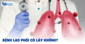 Bệnh lao phổi có lây không? Cơ chế lây nhiễm như thế nào? 1 lao phoi co lay khong