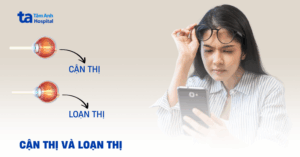 Loan Thi Khac Gi Can Thi