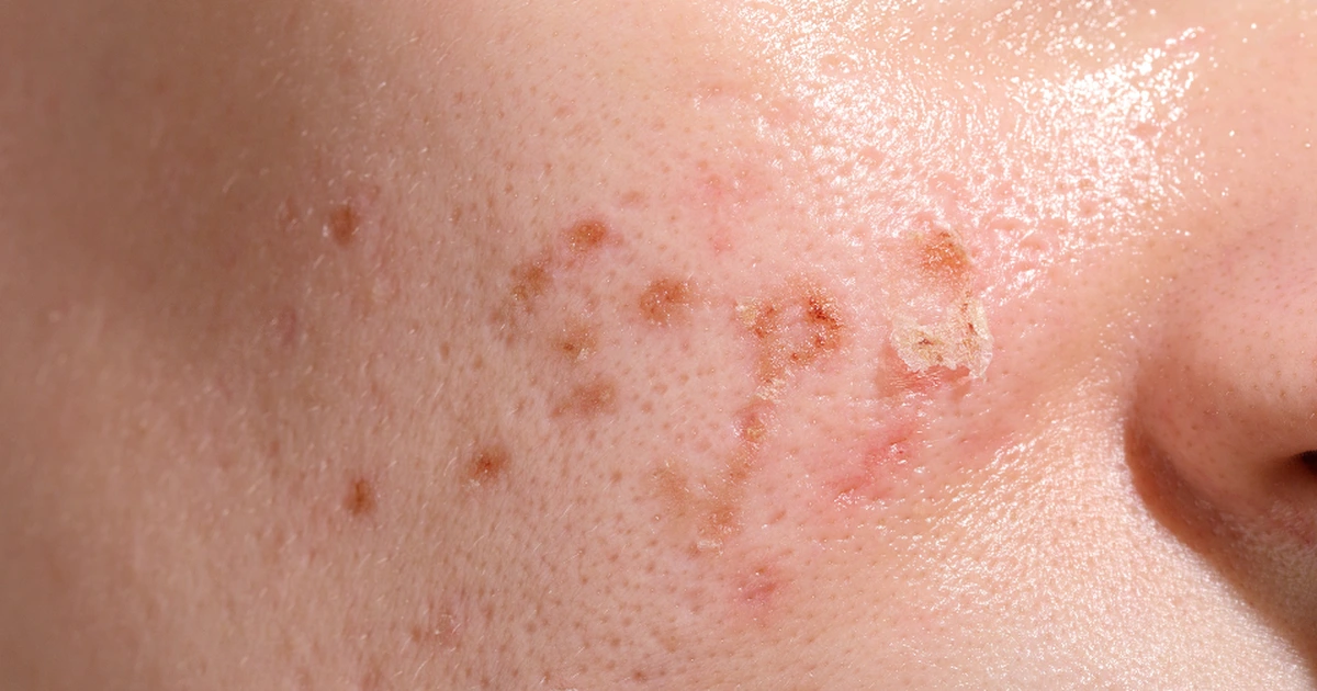 mai han 6 1 17755581682411806679129 136 0 639 960 crop 17755582533951048260647