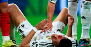 Mbappe đổ máu trên sân, Real Madrid tức giận bị ‘cướp’ phạt đền 1 mbappe do mau tren san real madrid tuc gian bi cuop phat den 458