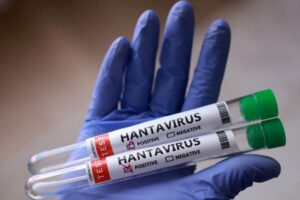 Truy vết Hantavirus: Các nhà khoa học bắt 70 con chuột ở "nơi tận cùng thế giới" 2 mmrbeea55zkrzpbsihsa53e6n4 20260520053833