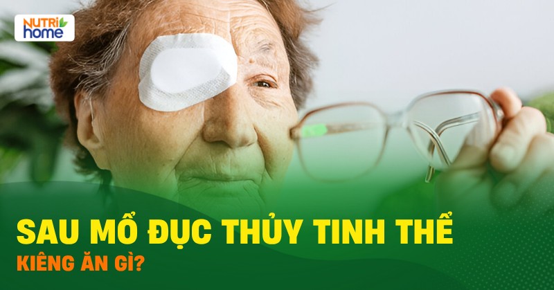 Mo Duc Thuy Tinh The Kieng An Gi 01