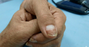 mong tay 17756610186261761023615 0 294 1396 2528 crop 1775661116727943708809