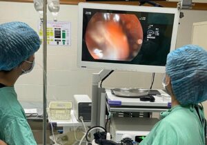 Cứu bệnh nhân nuốt cùng lúc 3 bàn chải đánh răng dài gần 20cm 1 mot ca benh hiem gap vua duoc cac bac si benh vien trung uong hue xu tri thanh cong bang ky thuat no