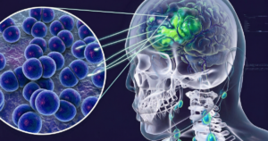 Cà Mau ghi nhận 3 ca nghi viêm não mô cầu, 1 trường hợp tử vong 3 nao mc 1775820778251451732866 79 0 1579 2400 crop 1775820818329820245647