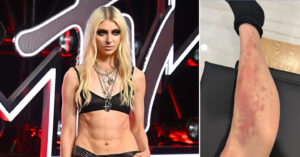 nu ca si 33 tuoi nhap vien cap cuu vi bi nhen doc can 2391.webp