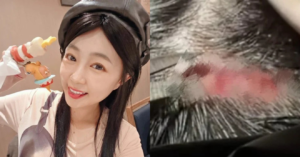 nu dien vien 38 tuoi nga dap dau khau 5 mui ngay sinh nhat 1788