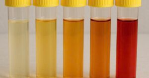 Nuoc Tieu 17510265772592124150141 82 0 716 1014 Crop 17687988652331852851657