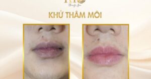 Photo1766195161259 1766195161392768347933 176666680691038867047