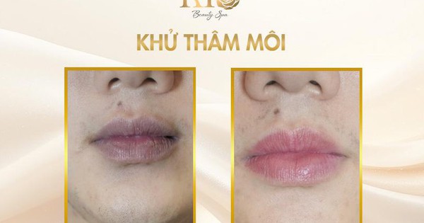 Photo1766195161259 1766195161392768347933 176666680691038867047