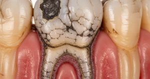 Vì Sao Thạch Tín Bị 'Khai Tử' Ở Nha Khoa Chính Thống? Rang Hong 1769675860816805825127 58 0 698 1024 Crop 17696758668651737582563