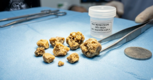 soi than 17745003637211157505398 0 131 768 1360 crop 1774500402375879814655