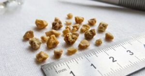 Soi Than2 17697841331501407221696 114 0 754 1024 Crop 17697841560521945163811