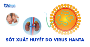 sot xuat huyet do virus hanta