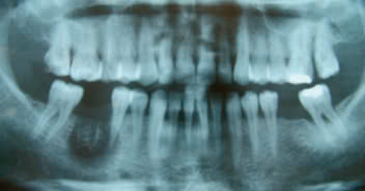 Suc Khoe 17700311558641592344781 64 0 704 1024 Crop 1770035873396344965853