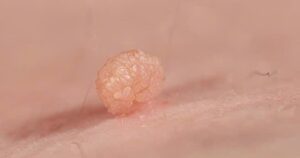 sui mao ga 1774090360331521222580 37 0 448 657 crop 1774090363947785658436