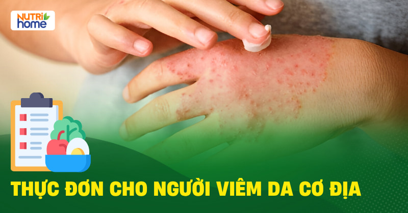 Thuc Don Cho Nguoi Viem Da Co Dia 01