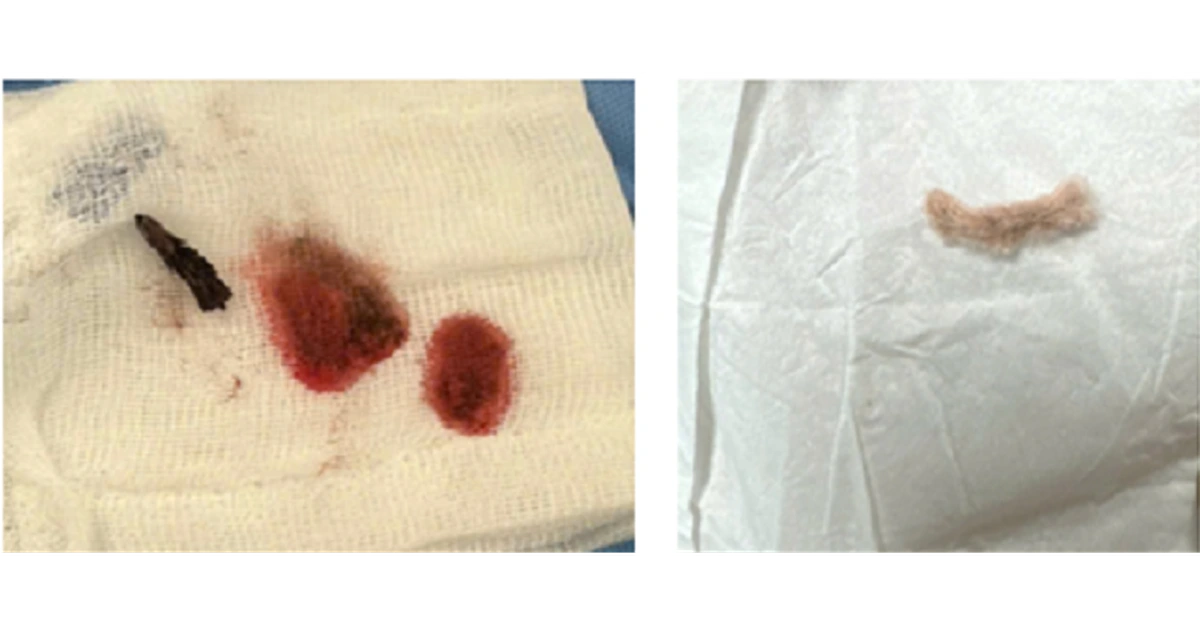 thumb di vat duong tho 17761822549231156829170 17761823341401599884541