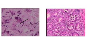 Thumb Giun Luon 17707091098971711010154 17707092972681172007139