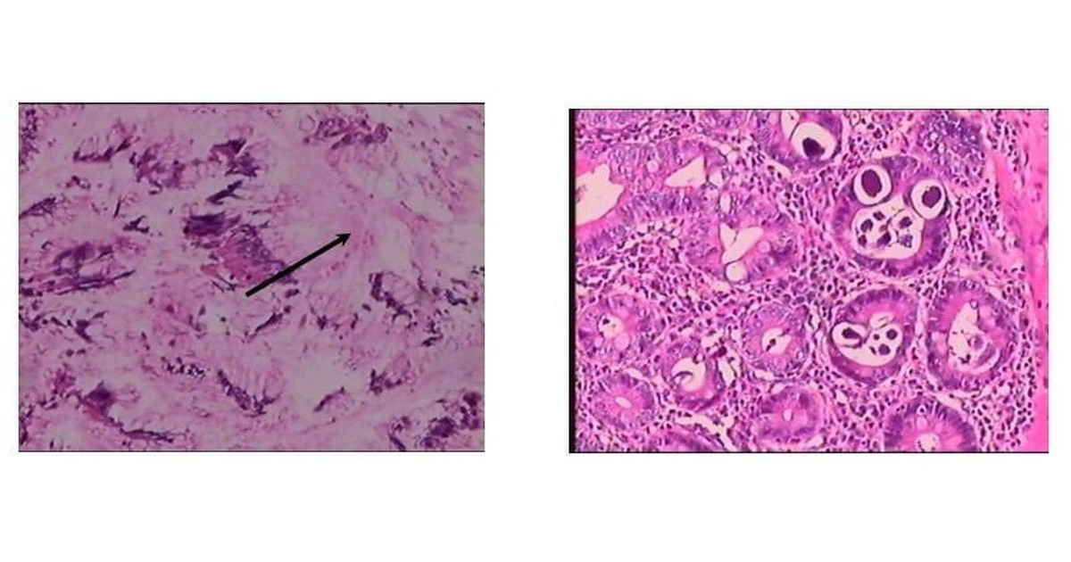 Thumb Giun Luon 17707091098971711010154 17707092972681172007139