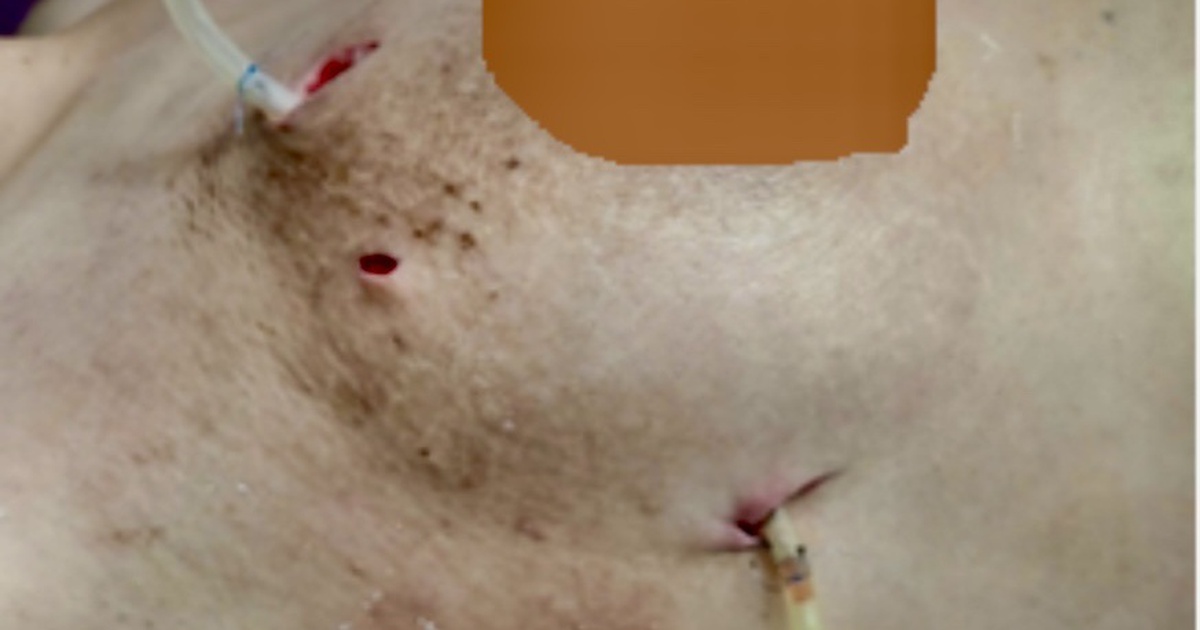 Tiem Filer 1766981621340615216062 49 0 595 873 Crop 1766981628452473779823