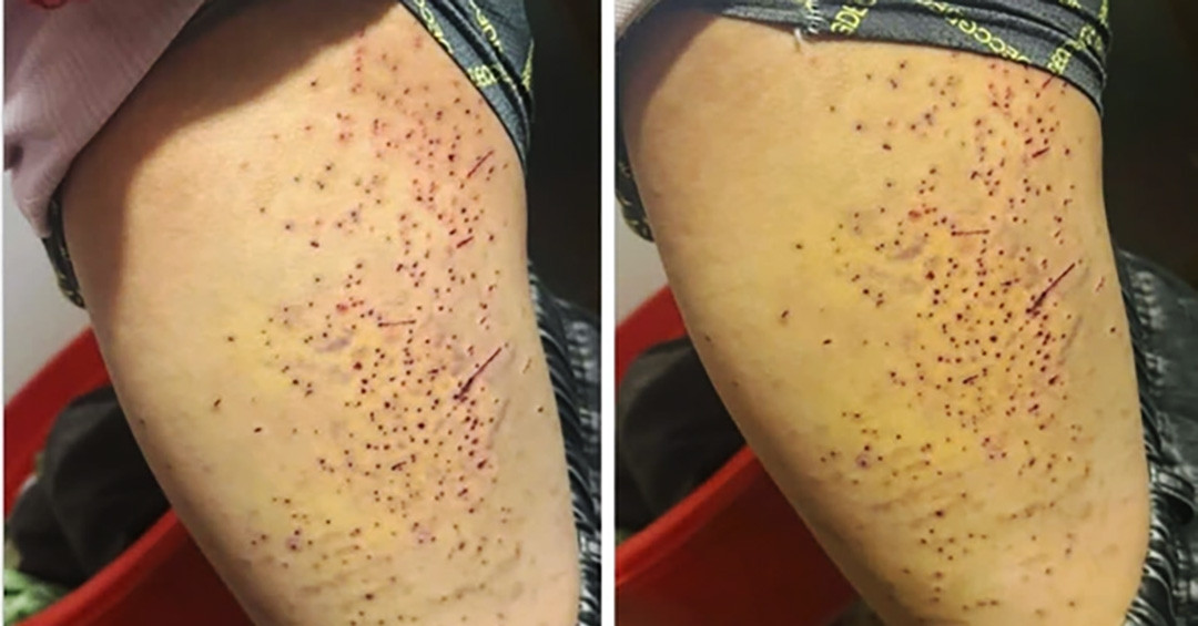 tranh chap cho ngoi nu sinh lop 7 dung but bi dam nhieu lan vao dui ban hoc 1480