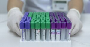 Bệnh án điện tử giảm xét nghiệm trùng lặp 1 tuan minh anh xn 1771984022331328891880 54 0 1654 2560 crop 17719840703681637439338