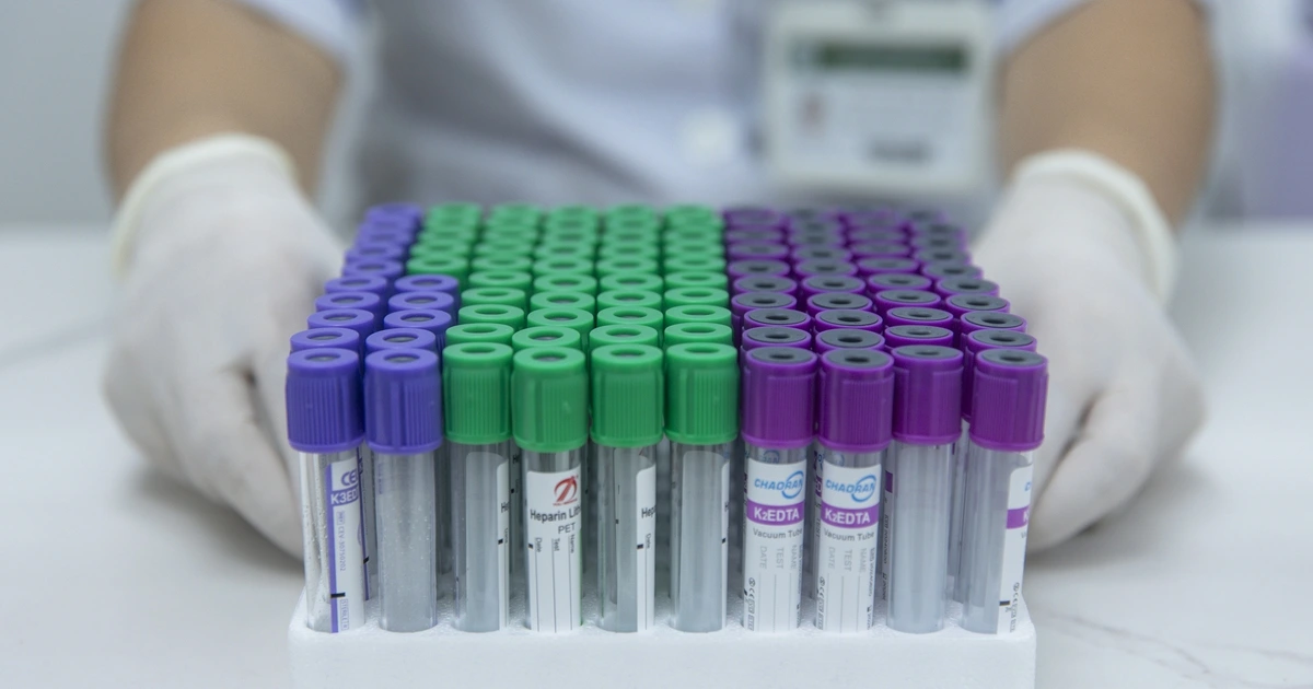 tuan minh anh xn 1776847435310716941182 0 0 1250 2000 crop 17768474491461246101872