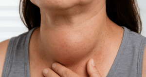 Tuyen Giap La Tuyen Noi Tiet Quan Trong Nhung De Mac Cac Benh Ly 17521460589201690715467 221 0 757 1