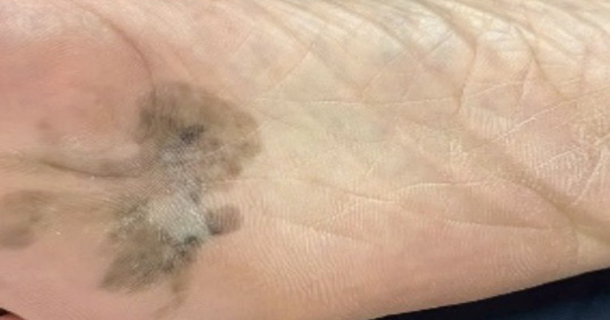 Ung Thu 17704340491651307339972 50 0 386 537 Crop 1770434054121978183926