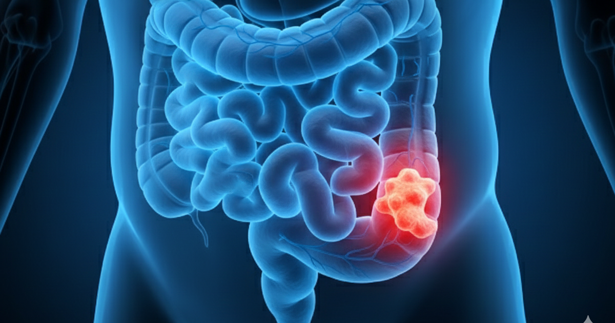 Ung Thu Dai Truc Trang Hoan Toan Co The Duoc Phat Hien Som Va Ngan Chan Hieu Qua Neu Moi Nguoi Tre D