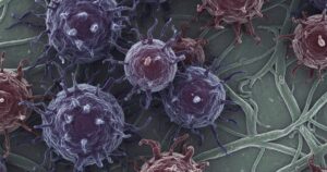 Ung Thu M 17706139068721317668635 88 0 728 1024 Crop 17706140596881242042216