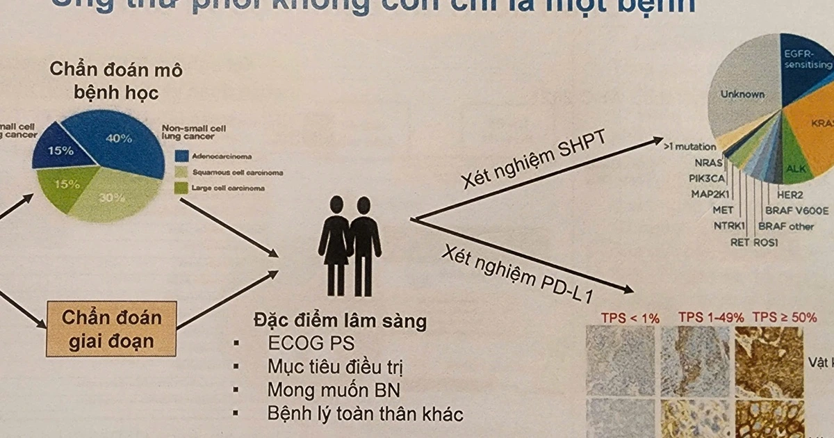 ung thu phoi 2 17759828684001618099364 0 0 1547 2475 crop 1775982883246420604395